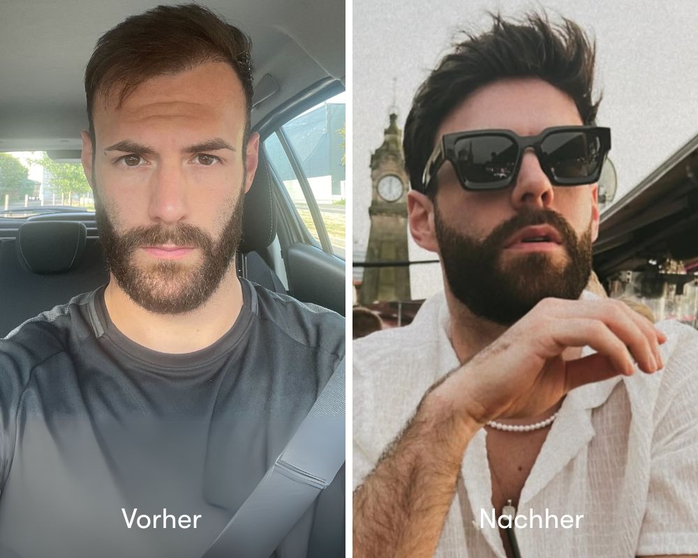 Native Vorher vs. Nachher (1)