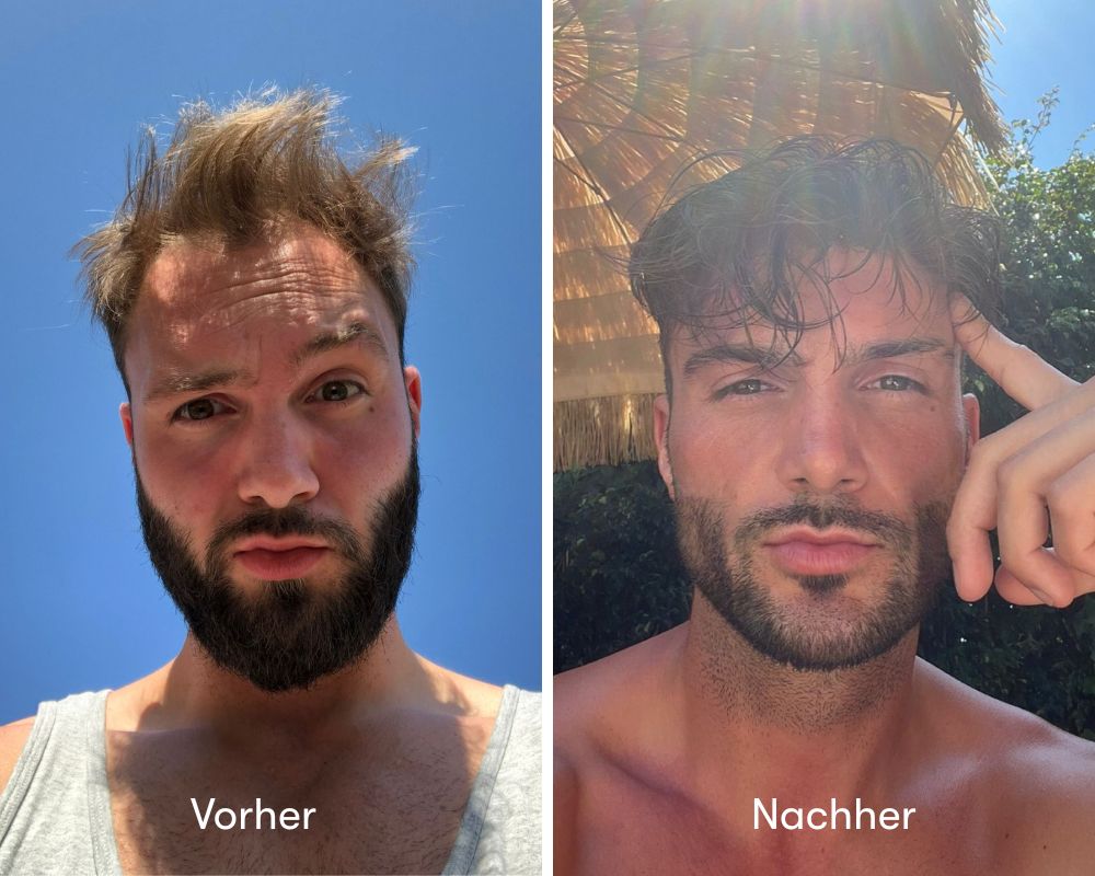 Vorher_Nachher Chris